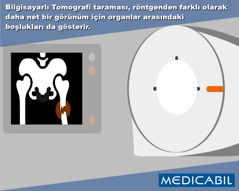 BT Kemik