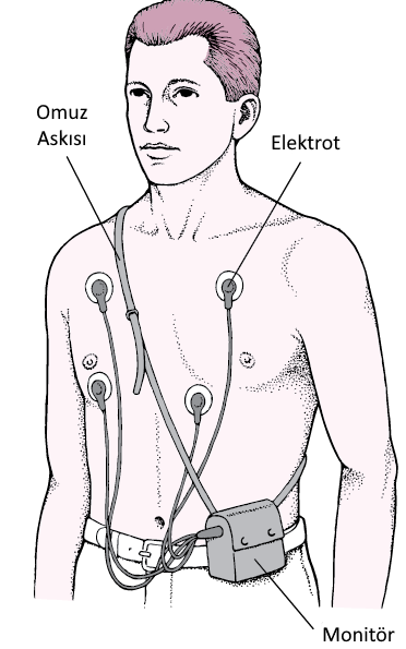 Holter Monit&ouml;r&uuml;