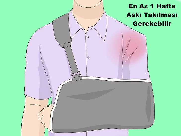  En Az 1 Hafta Askı Omuz &Ccedil;ıkığı