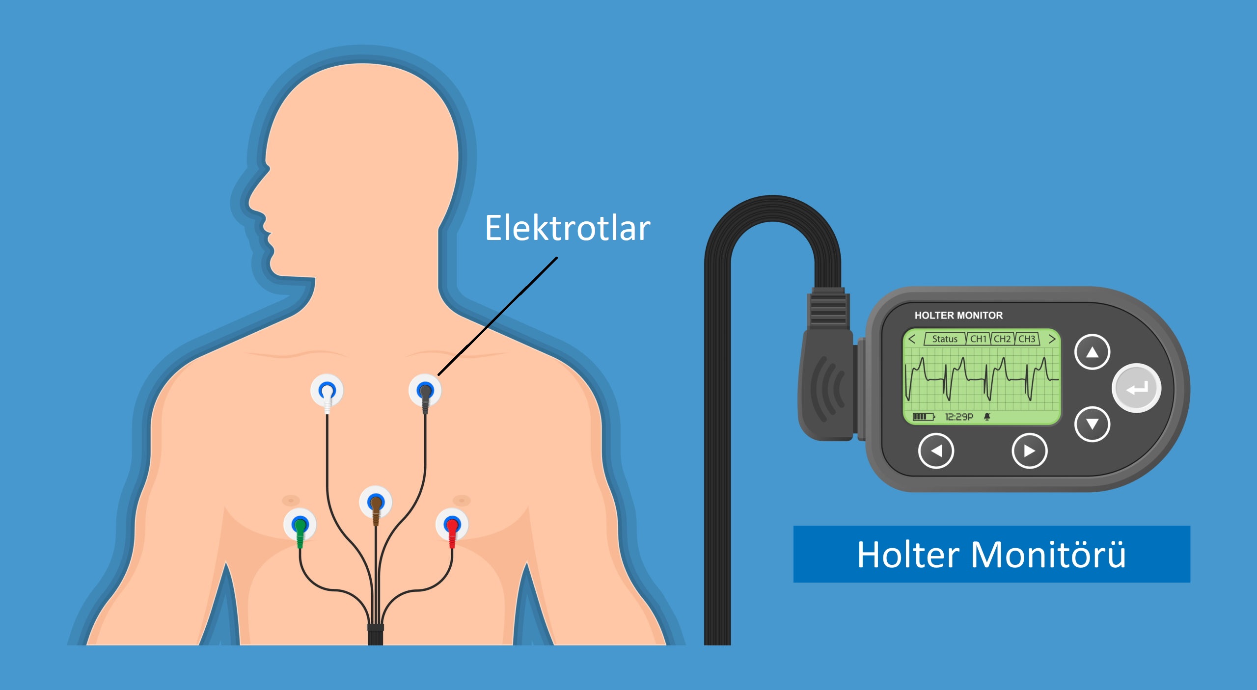 Holter