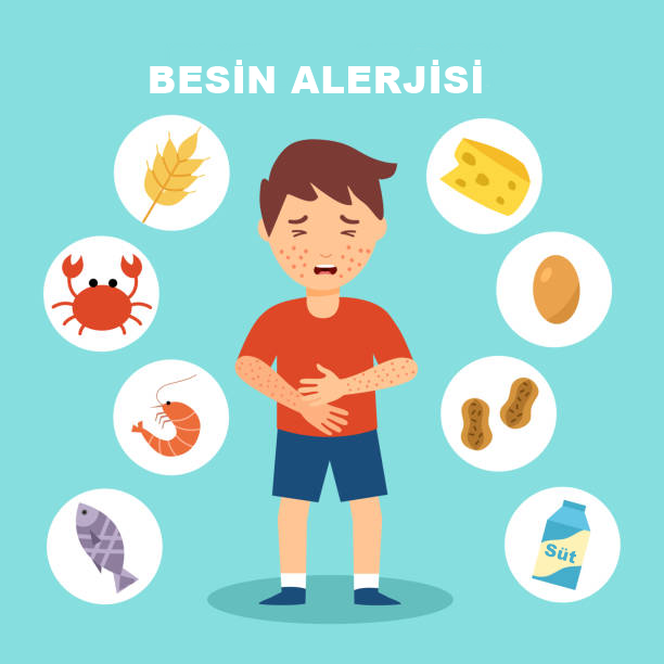 Besin Alerjisi