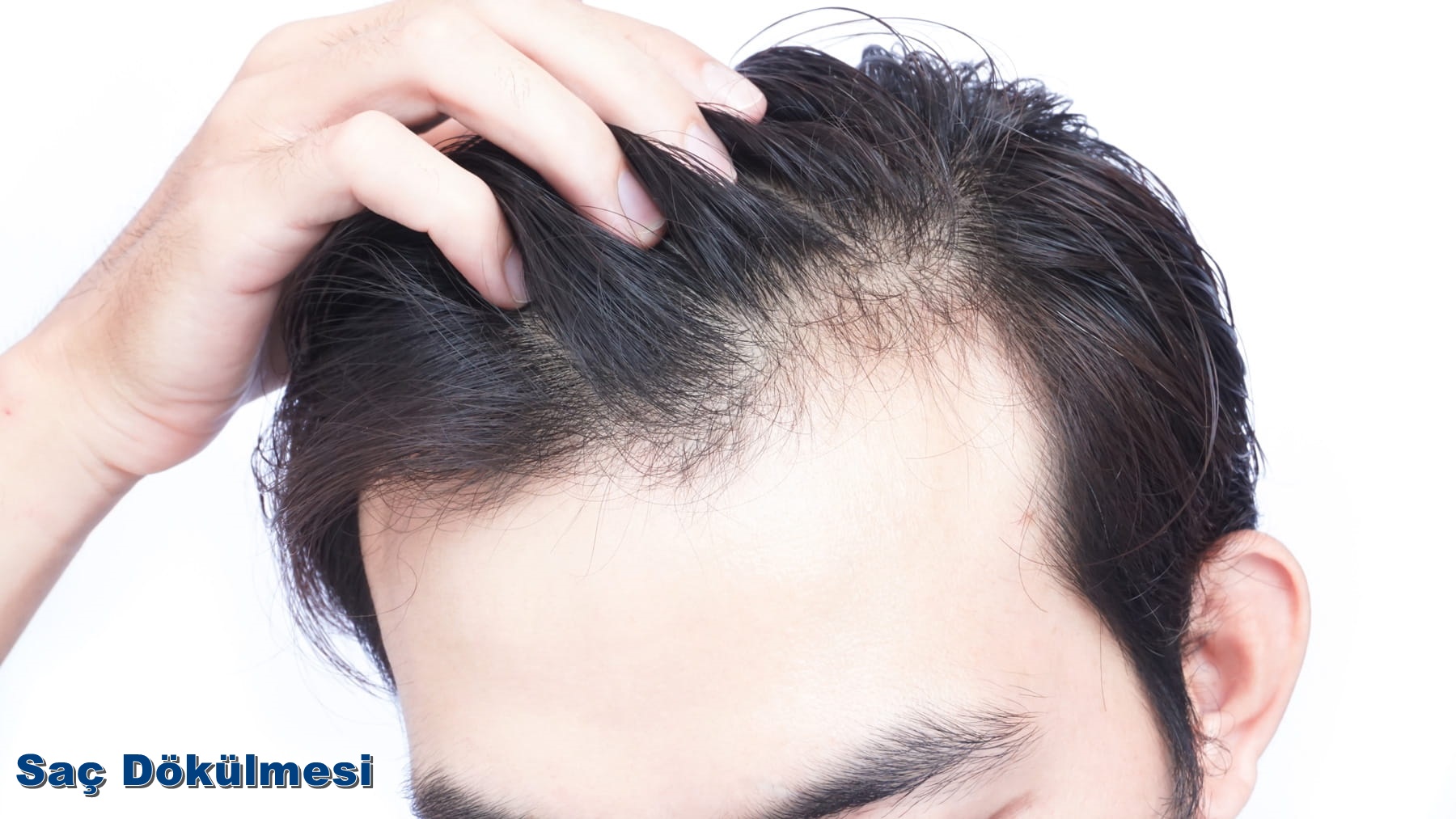 Sa&ccedil; d&ouml;k&uuml;mesi nedir?