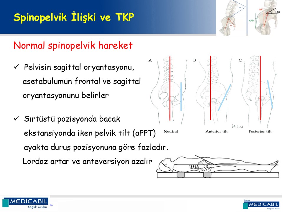 Slide 14