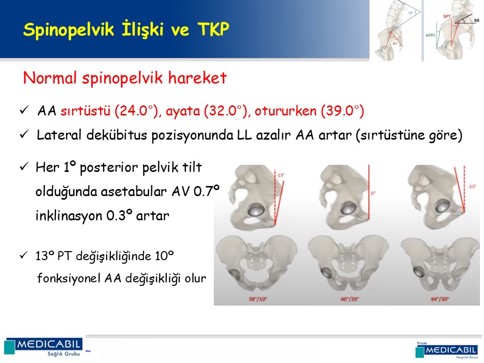 Slide 15