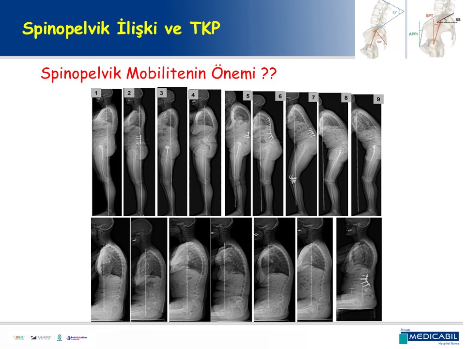 Slide 16