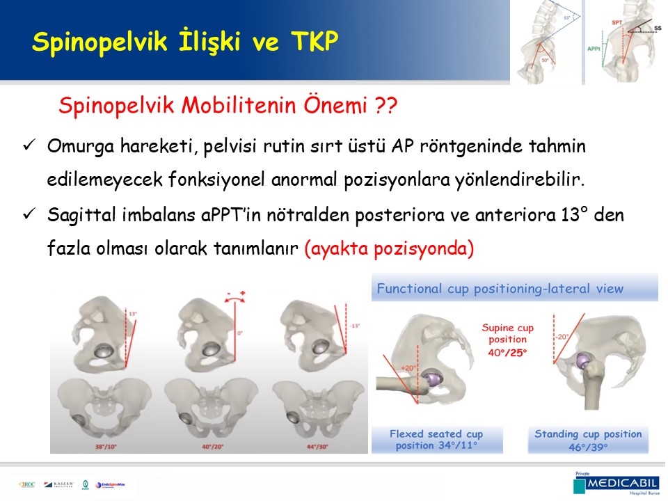 Slide 17