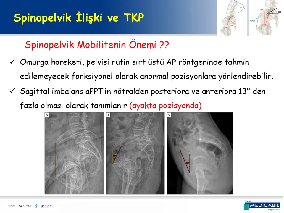 Slide 18