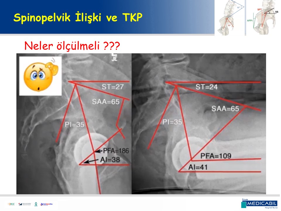 Slide 19