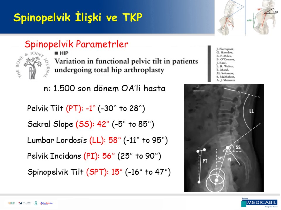 Slide 21