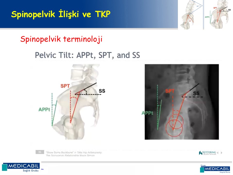 Slide 22
