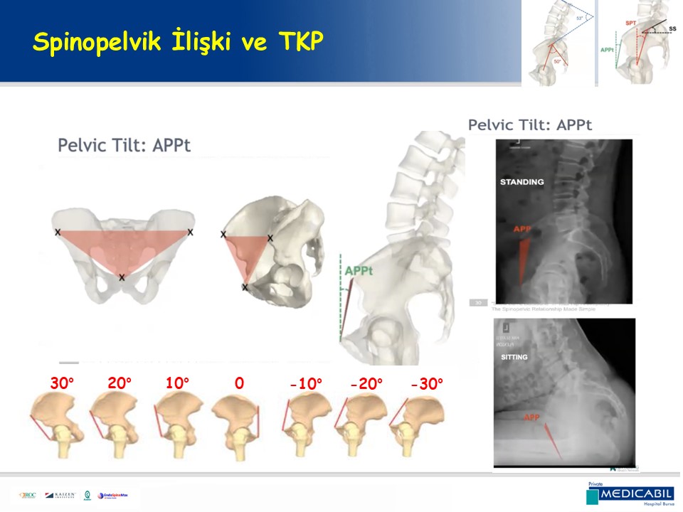Slide 23