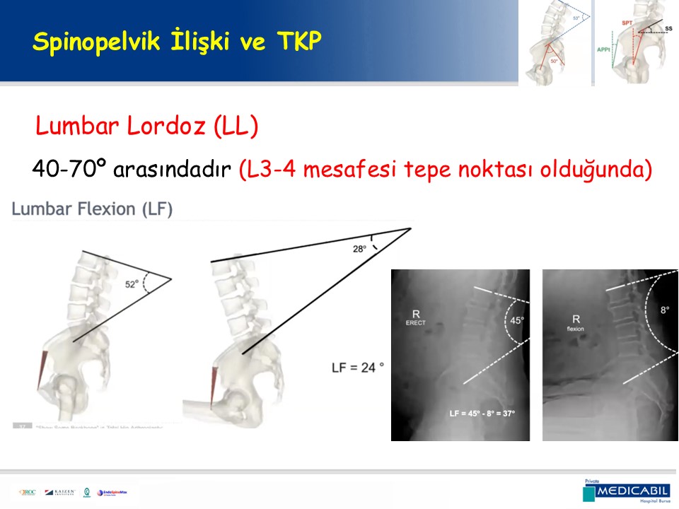 Slide 29
