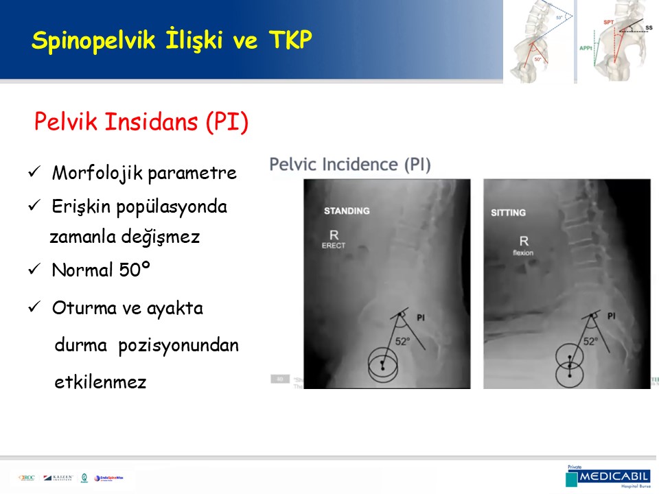 Slide 31