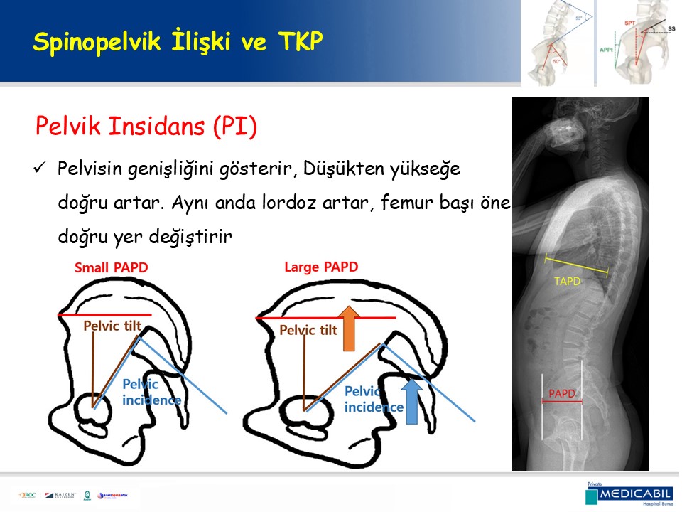 Slide 32