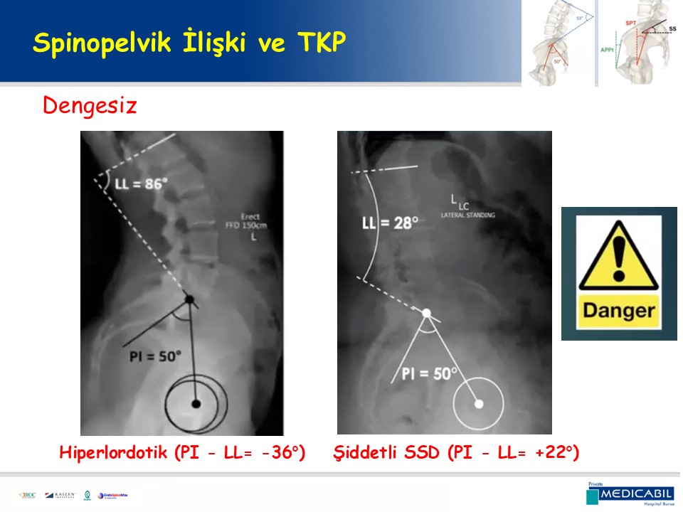 Slide 47
