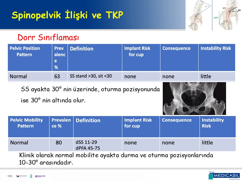 Slide 51