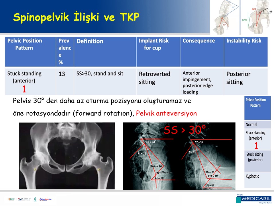 Slide 54