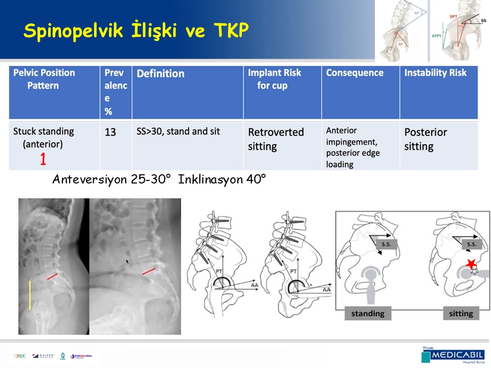 Slide 55
