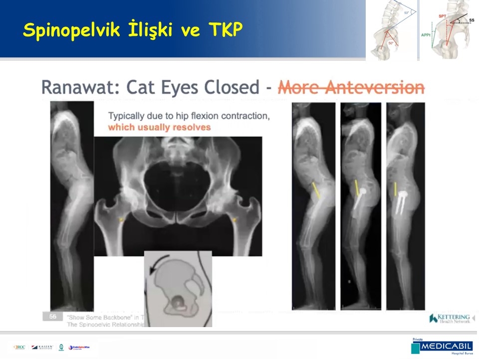 Slide 56