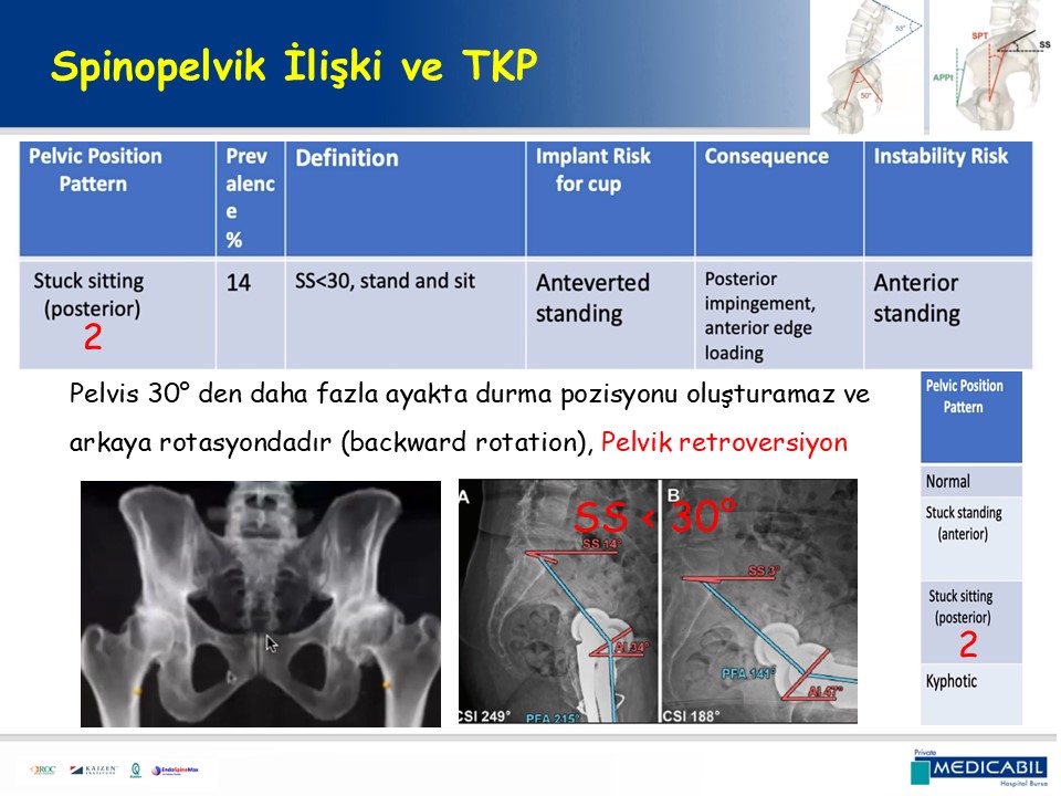 Slide 57