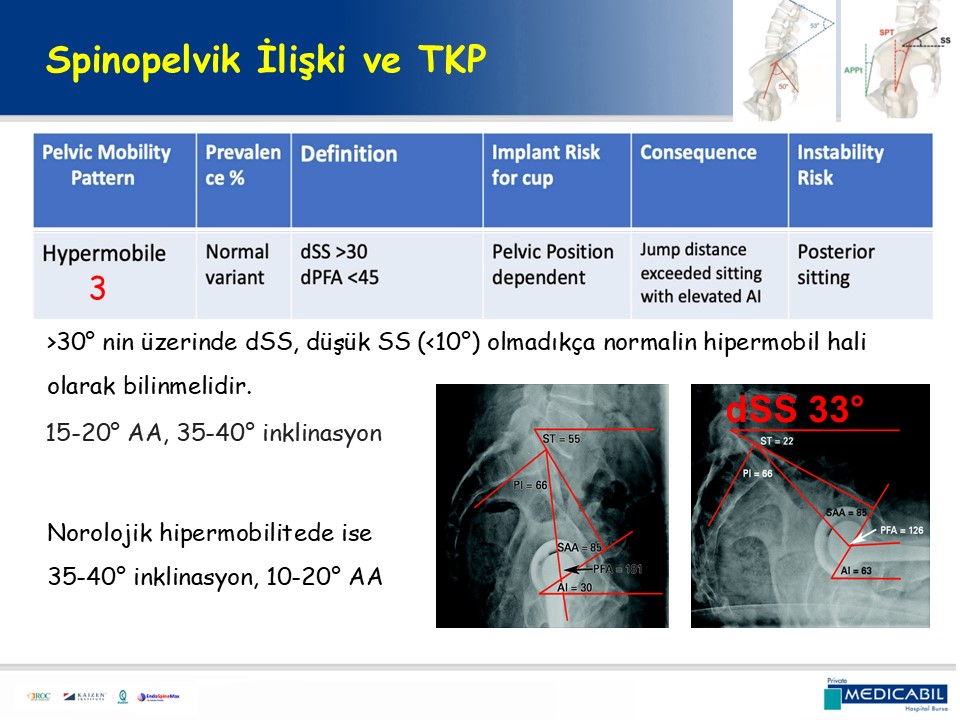 Slide 61