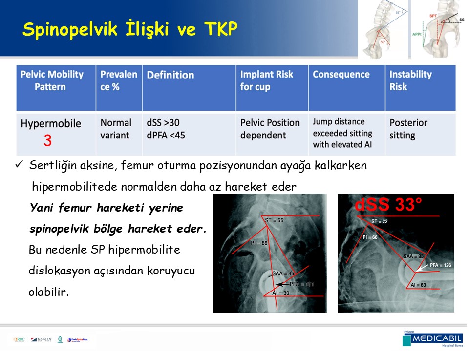 Slide 62