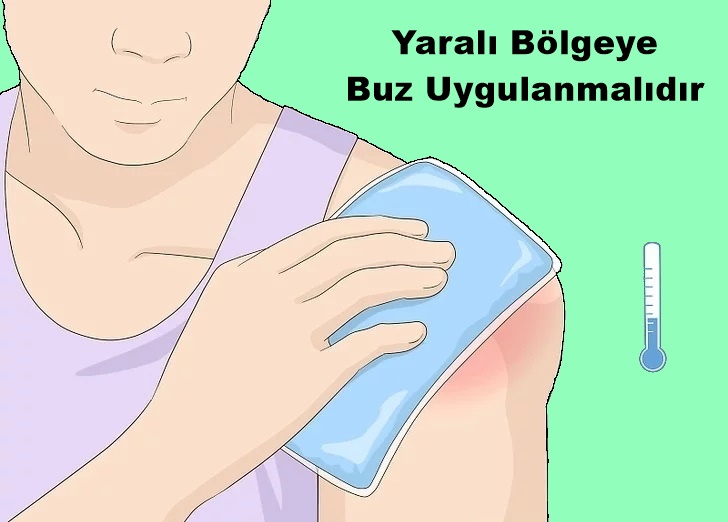  Omuz &Ccedil;ıkığı Buz Uygulaması